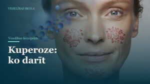 Kuperoze: ko darīt