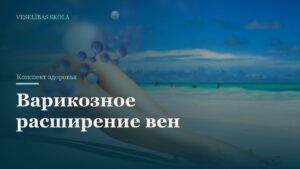 Варикозное расширение вен