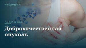 Доброкачественная опухоль