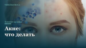 Акне: что делать