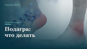 Подагра: что делать
