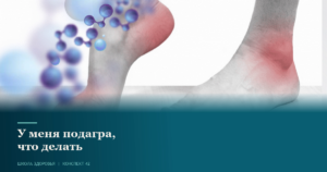 42. У меня подагра, что делать