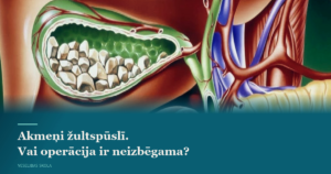 46. Akmeņi žultspūslī. Vai operācija ir neizbēgama?